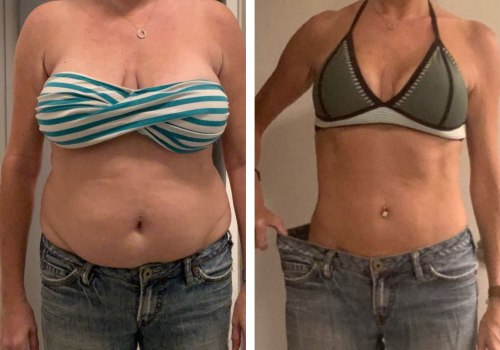 Understanding Weight Loss Results with Semaglutide